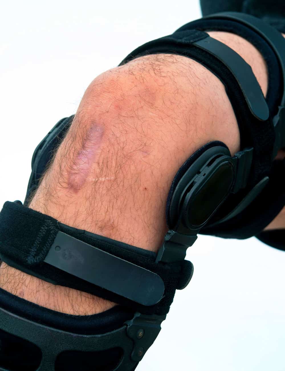 Don Joy Knee Braces
